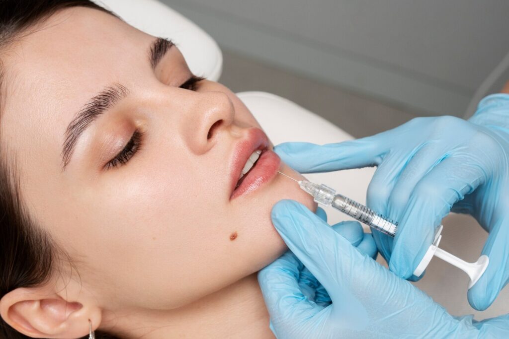 O preenchimento labial quando bem executado, oferece resultados naturais e elegantes.